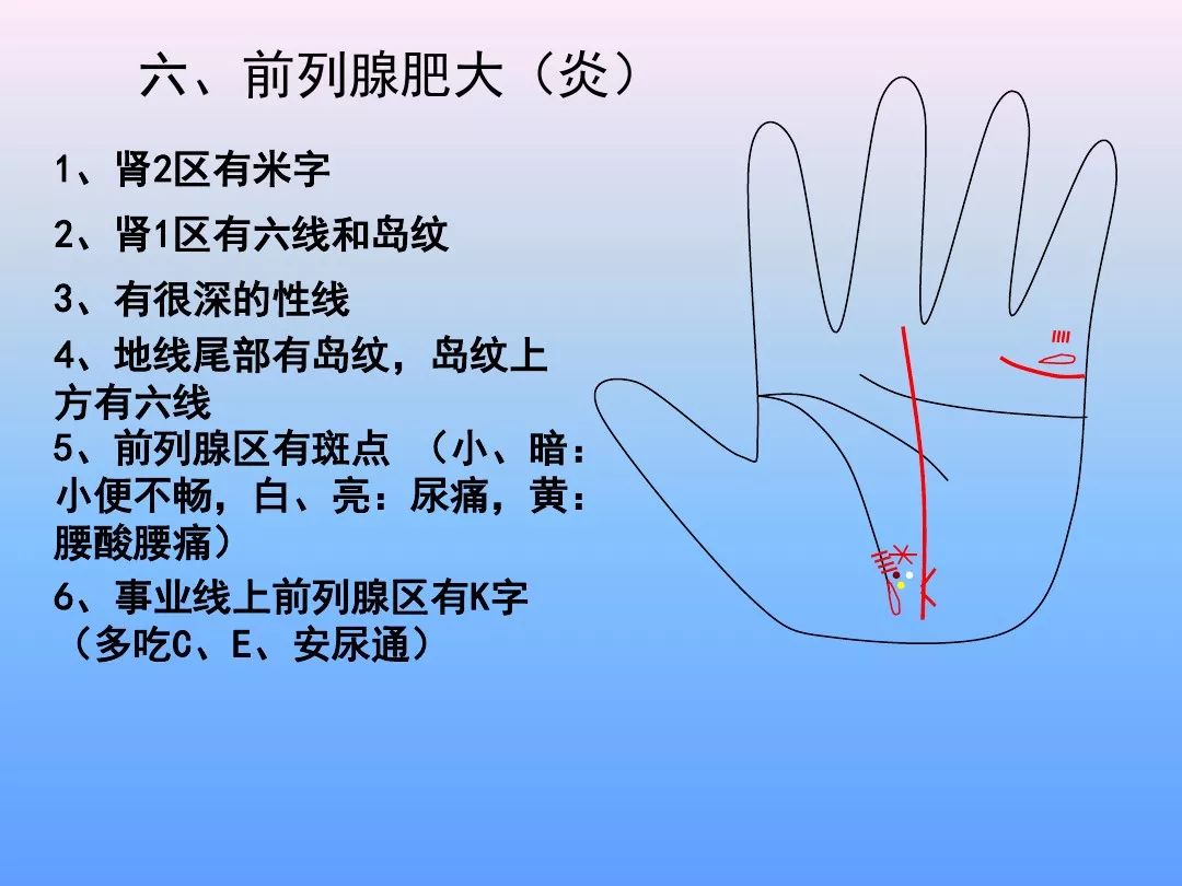 最全手诊(一看就懂)