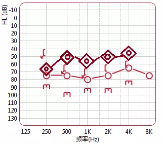 重振明显的用户在真耳分析监测下调试