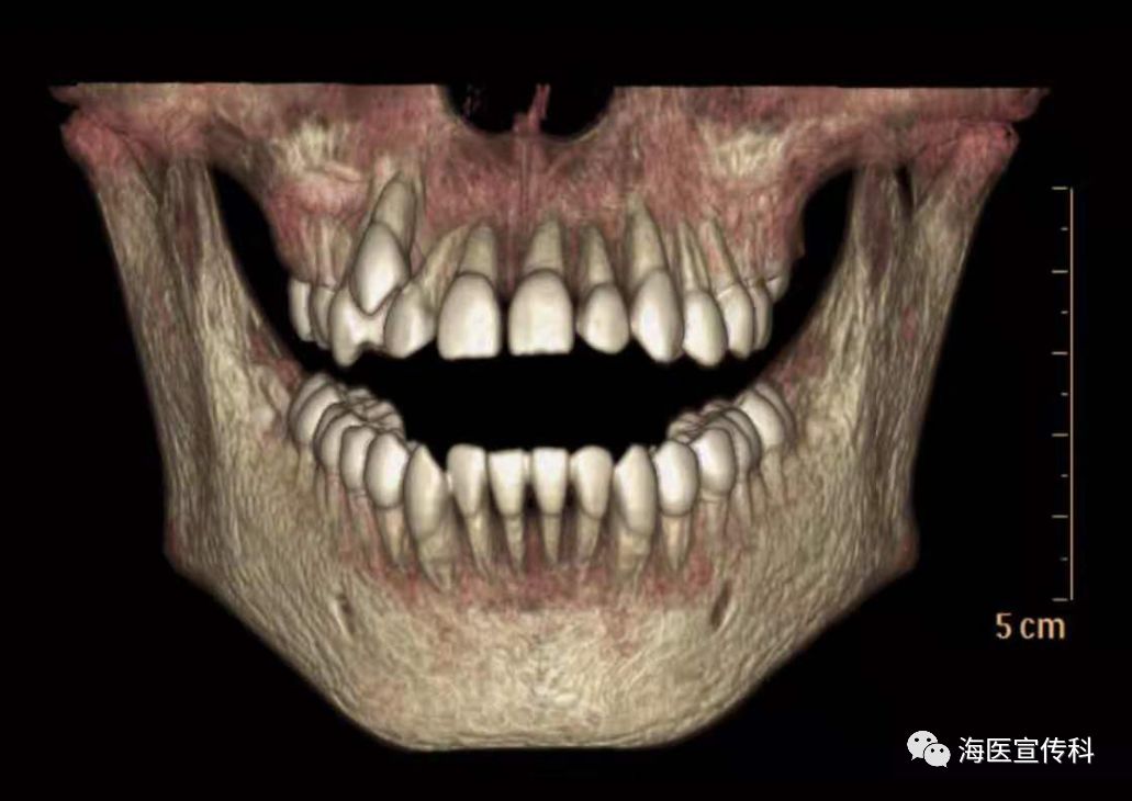海伦市人民医院ct室新开展颌面部牙齿三维ct检查应用技术