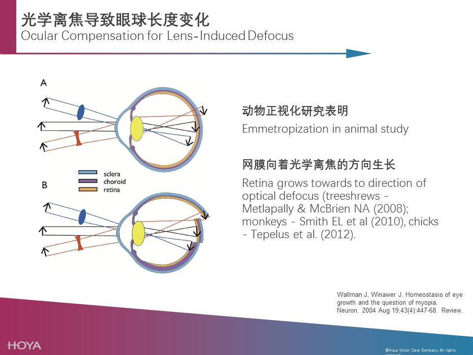 新乐学 在光学镜片中引入近视离焦的全新技术