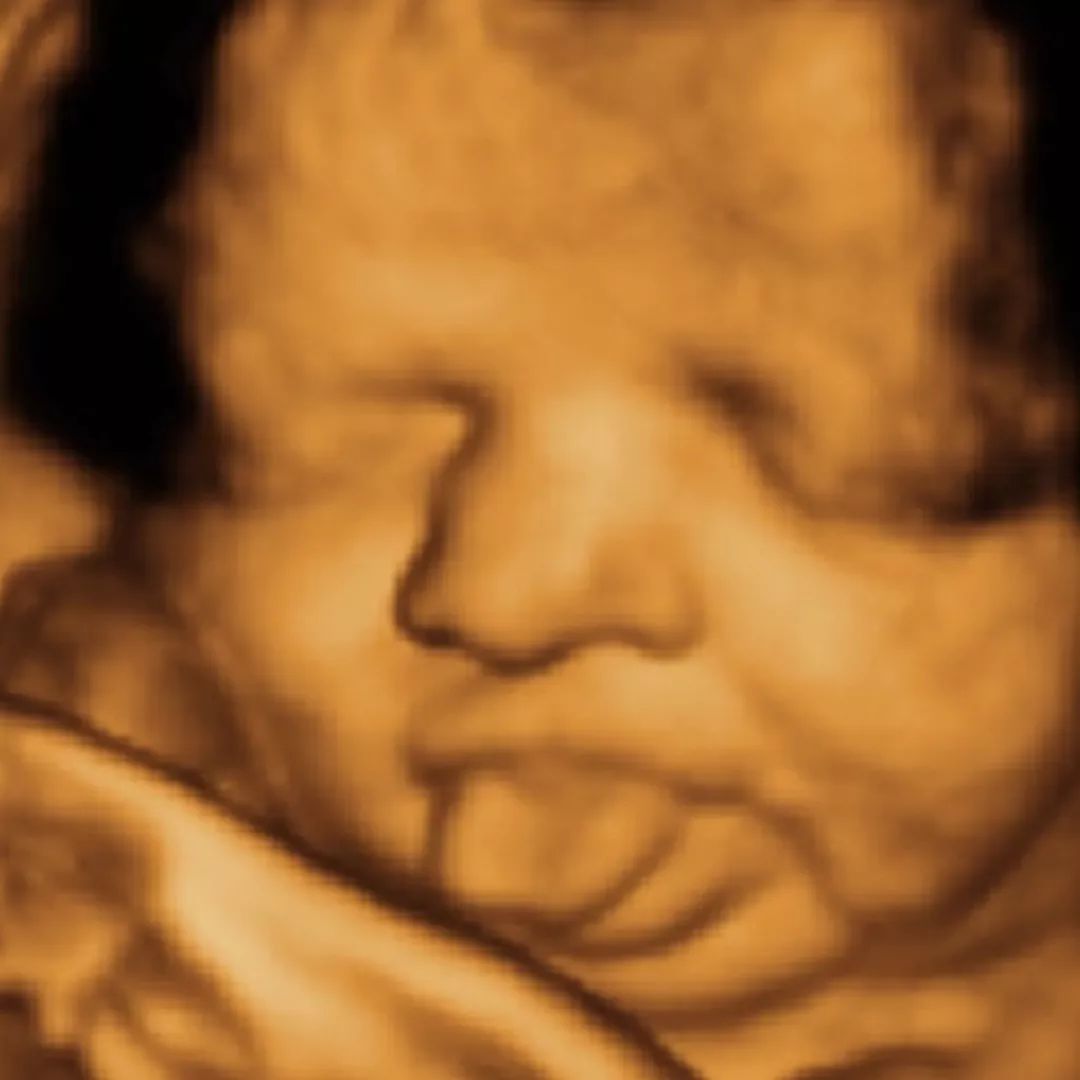 胎儿无聊时在妈妈肚子里都干点啥?看一遍笑一遍.