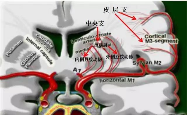 大脑中动脉分段与分支