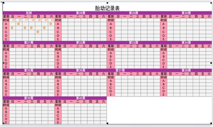 左侧或静坐,记录10次胎动所需时间,分a,b,c,d,e,画于表内空格,e为异常