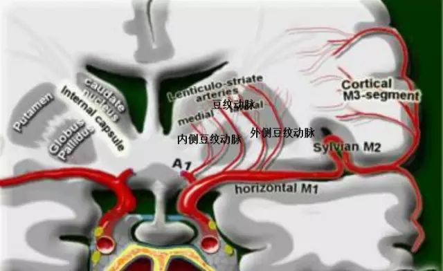 大脑中动脉分段与分支