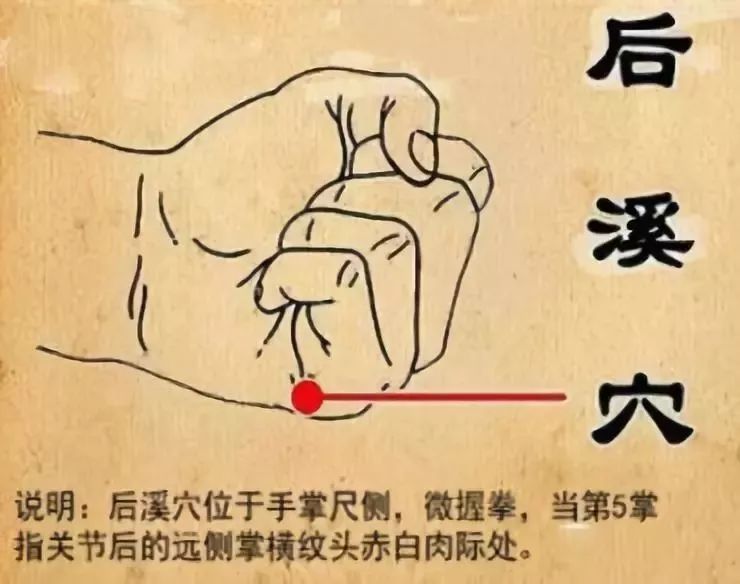 取穴位置:后溪穴位于人体的手掌尺侧,微握拳,当第5掌指关节后的远侧