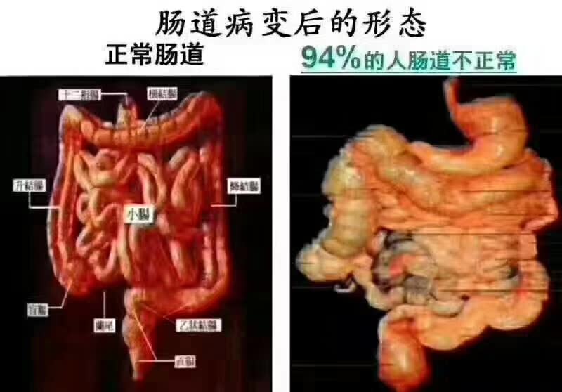 一日三餐吃进去,很多没有排出去的食物残渣留在40度的肠道褶皱里发酵