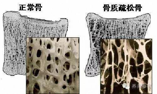 雌二醇降低了怎么办