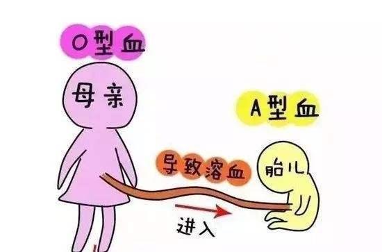 孕妇溶血怎么办