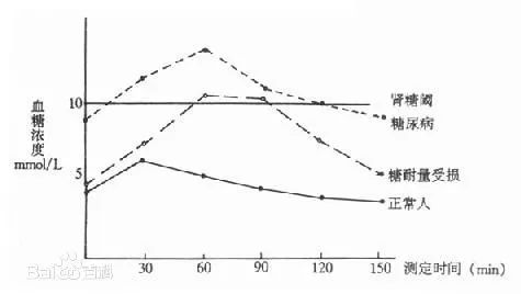 诊断糖尿病的"金标准:糖耐量试验