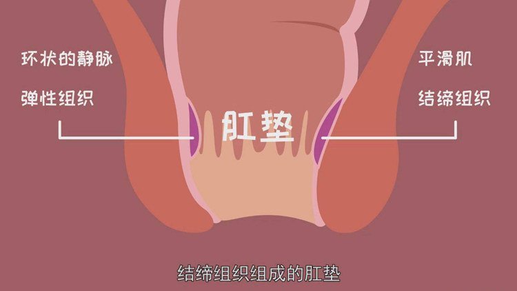 长痔疮是怎样一种体验?