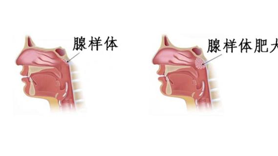 快看看有没有这些症状!