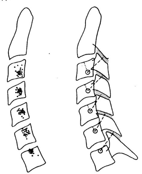 典型的颈椎间关节旋转示意图 说明椎体的旋转运动穿过钩突的斜凹,并