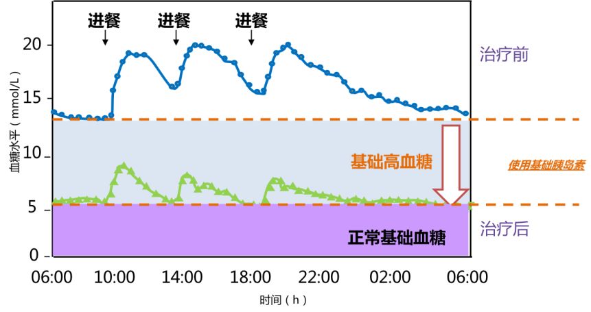 图3 使用基础胰岛素降低基础高血糖一几经探索寻求fbg最佳控制目标