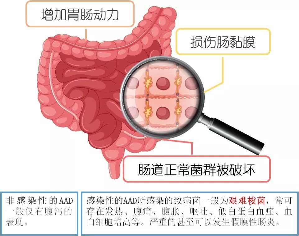 药物性腹泻怎么办