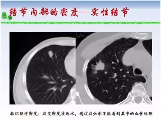 眼睛瘙痒与疼痛：常见原因及应对措施