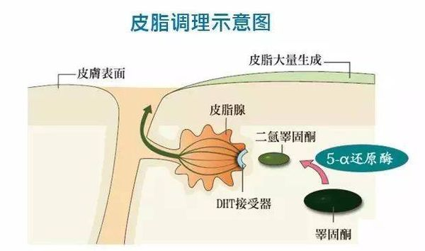 20多岁脱发怎么办