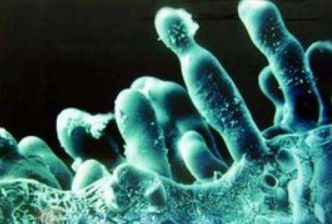 什么是真菌病害?什么是细菌病害?如果不懂