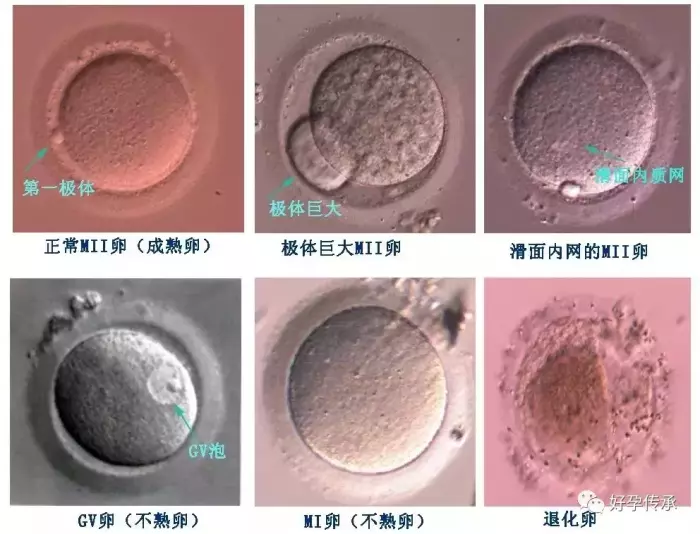 普通的光学显微镜无法看到卵母细胞的纺锤体.