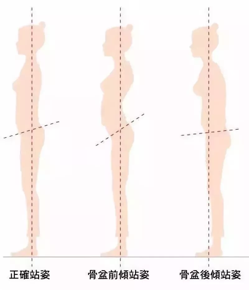 长得美也没用,有这7个体态问题,还是会气质全无!