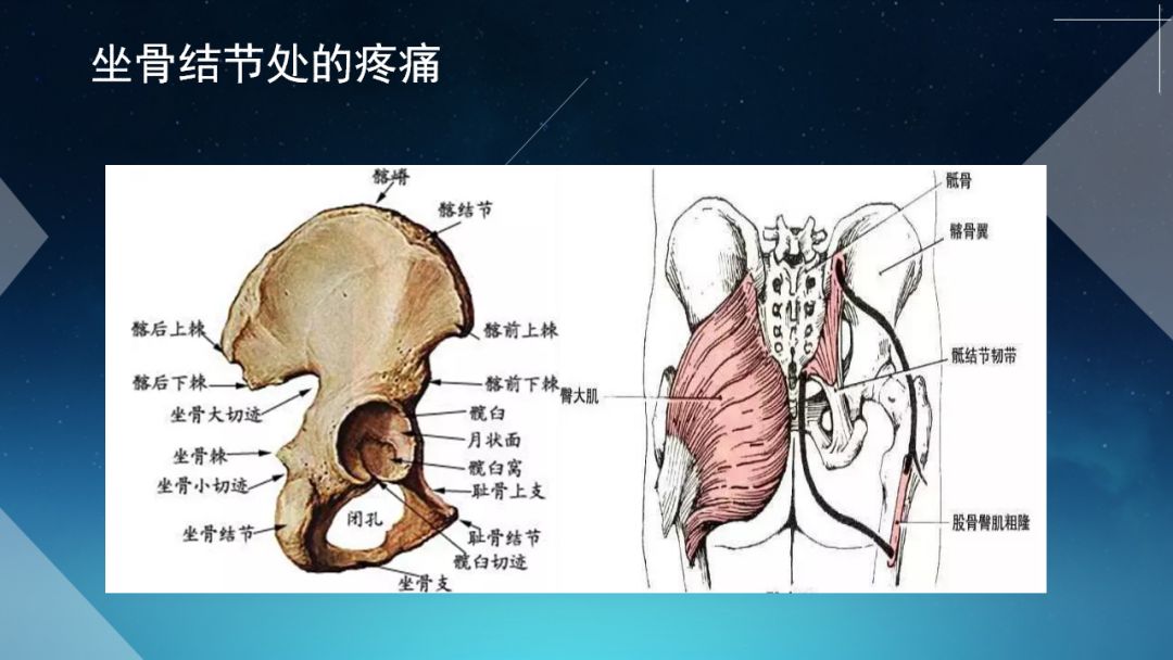 留言解读【腰方肌】