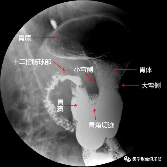 站立右前斜位10仰卧左前斜位09右侧卧位08此时显示的是,胃底黏膜相