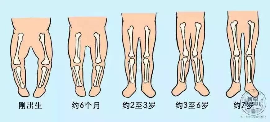 有关宝宝的腿型问题,这里讲明白了,点进来看看!