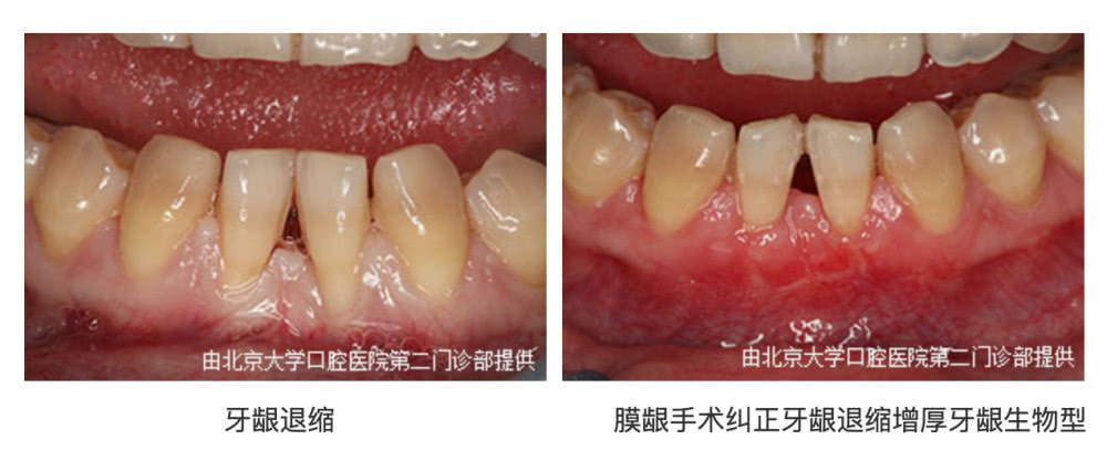 人口中有多少牙齿_奥特曼中有多少种怪兽(2)