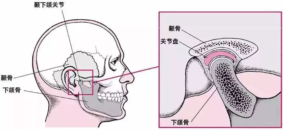 严重时,就连吃饭,说话,打哈欠,下巴都咔咔响,或者是突然张大嘴巴时