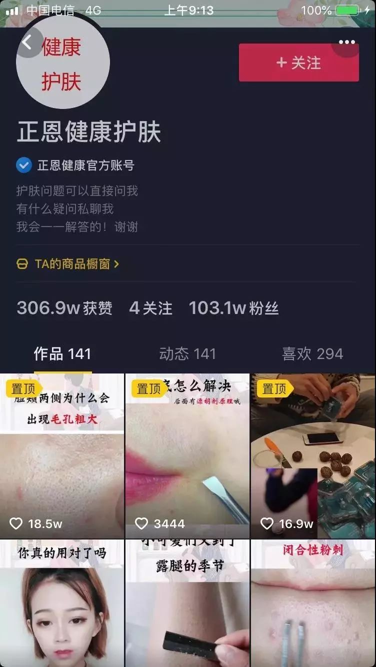 运营|抖音基础问题之——为什么我不能置顶视频？