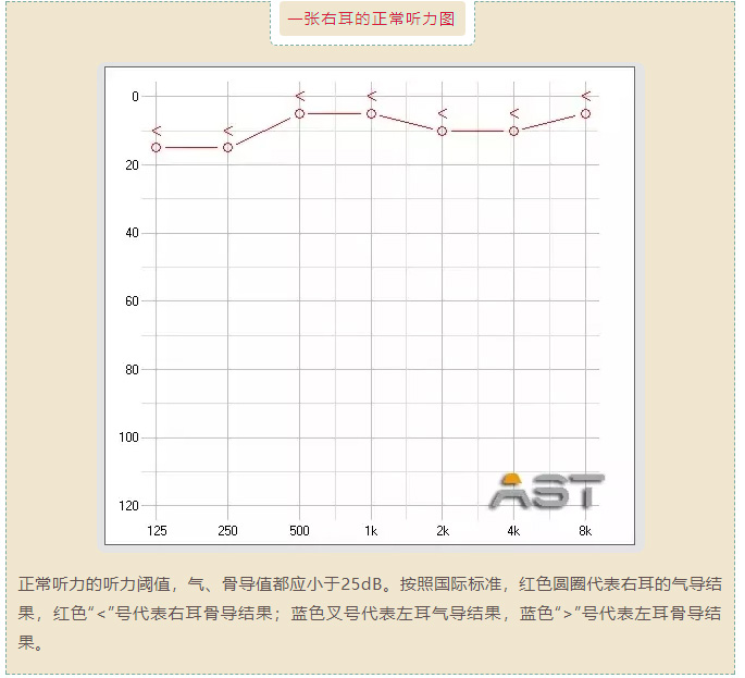 听力下降到什么程度?一张图就看懂了