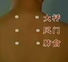 治病三针有图一看就懂