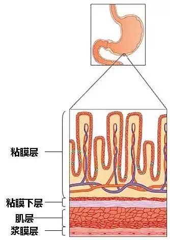 正文报告中提及肿瘤浸润胃壁全层,胃壁是胃的哪部分?
