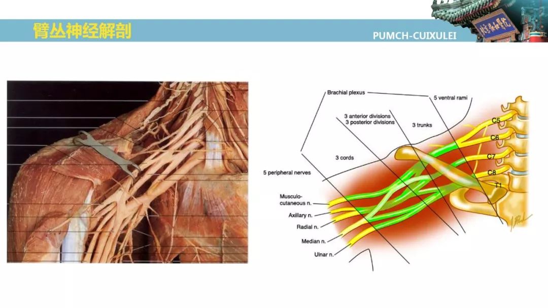 臂丛由第5~8颈神经前支和第1胸神经前支大部分组成.