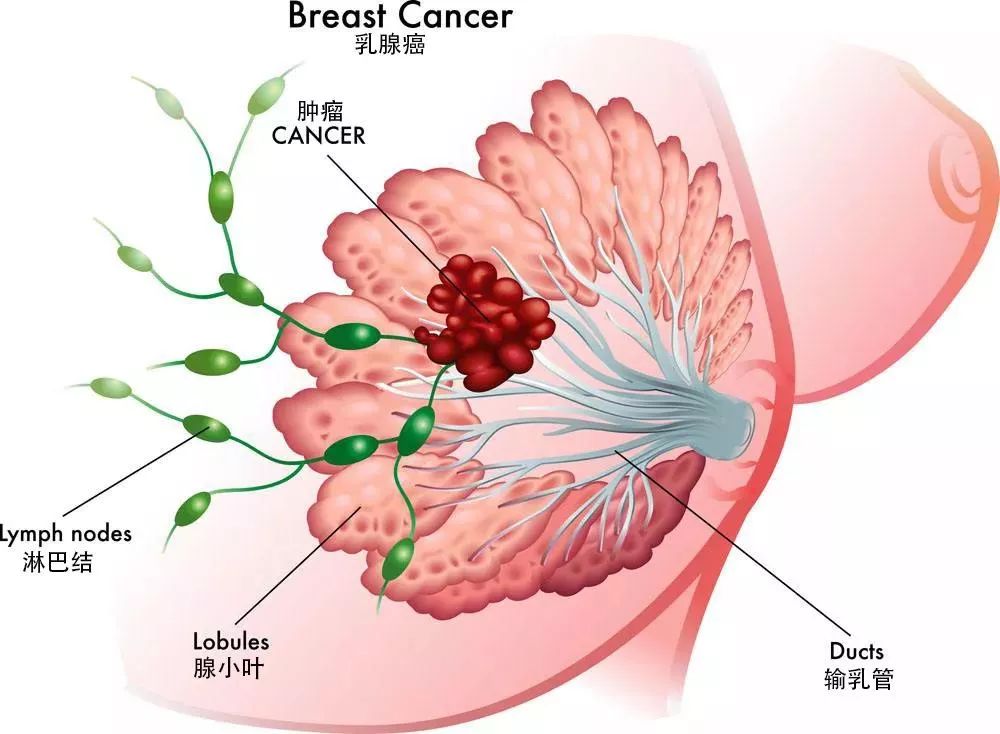 乳腺麦默通微创技术让您拥有美丽和健康