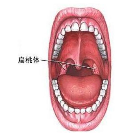 扁草体发炎怎么办