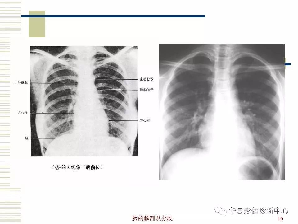 肺的解剖与分段