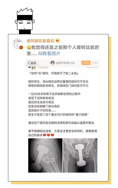 男子体内取出80cm长异物,x光片把医生看懵了