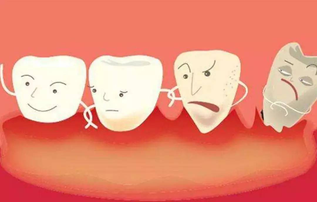 高医生告诉你:到底是哪里出了问题让你患上牙周病