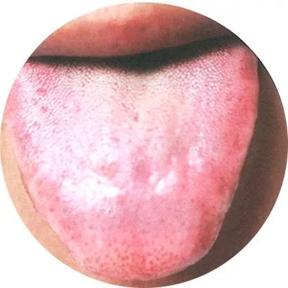 舌诊 高清图片