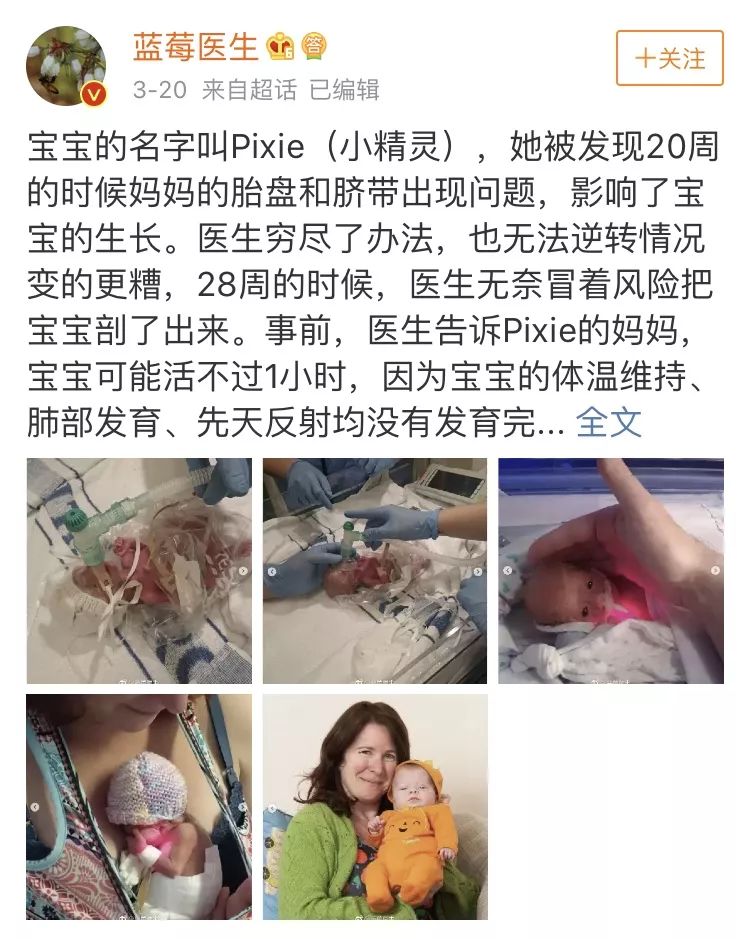 "袋鼠包"拯救28周早产宝宝:比保温箱还靠谱的护理你一定要知道!