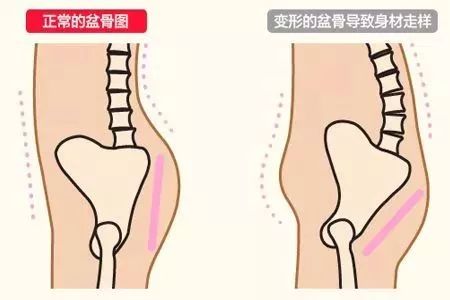 明明四六的黄金比例身材,因为假胯宽看上去就跟五五分的小短腿儿似的!