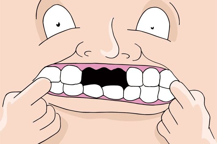 长期缺牙,有什么危害?