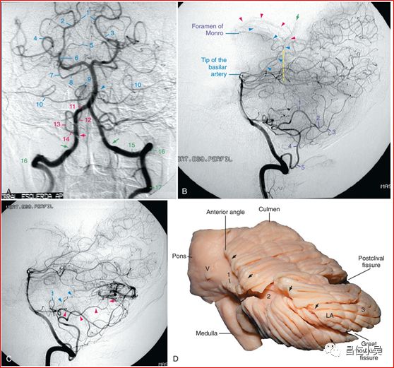 解剖学习笔记椎基底动脉系统