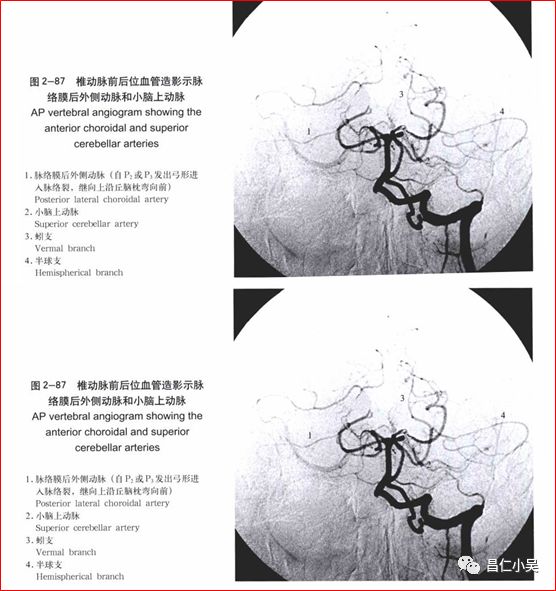 解剖学习笔记椎基底动脉系统