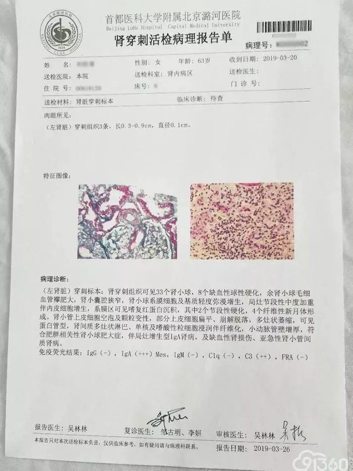 潞河医院肾脏病理工作开启新篇章