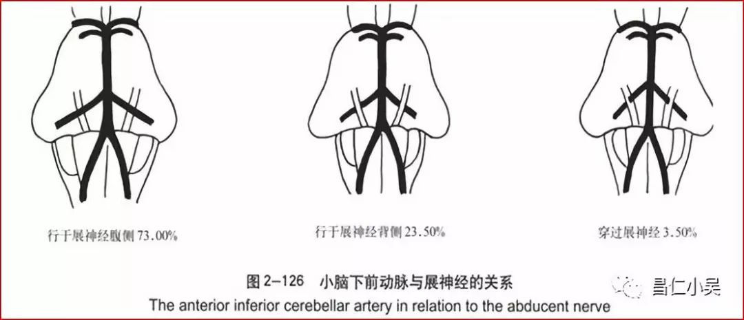 桥脑前端:位于斜坡和桥脑腹侧之间,此段常与外展神经根丝接触.1.8.