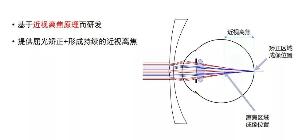 树脂近视镜片是什么原理_近视镜片h是什么牌子(2)