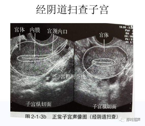 子宫及附件解剖及生理