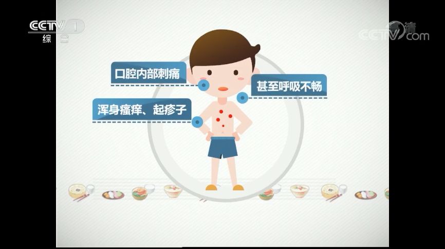 【涨姿势】喝酒脸红,吃肉长痘都不是过敏!食物过敏长这样