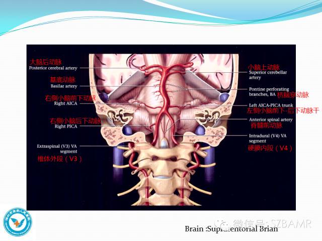 椎-基底动脉系统ct,mr及dsa影像解剖_血管